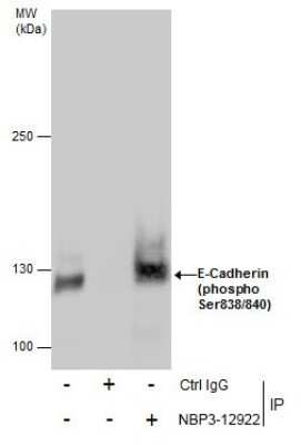 Immunoprecipitation: E-Cadherin [p Ser838, p Ser840] Antibody [NBP3-12922] - Immunoprecipitation of E-Cadherin (phospho Ser838/840) protein from MCF-7 whole cell extracts using 5 ug of E-Cadherin (phospho Ser838/840) antibody (NBP3-12922). Western blot analysis was performed using E-Cadherin (phospho Ser838/840) antibody (NBP3-12922). EasyBlot anti-Rabbit IgG was used as a secondary reagent.